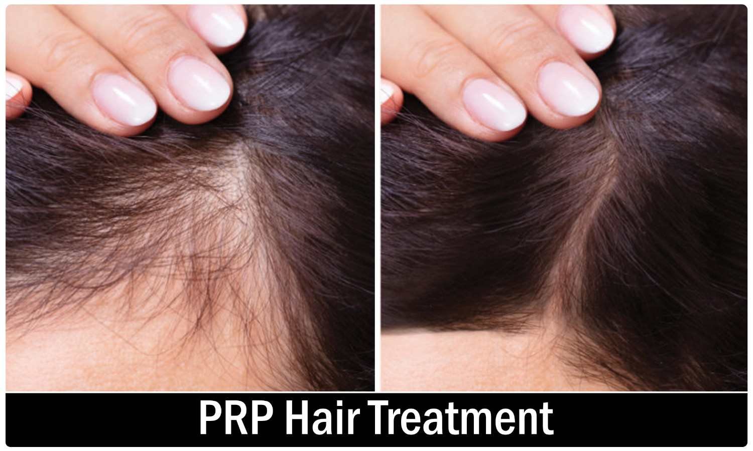 Hair and scalp consultation