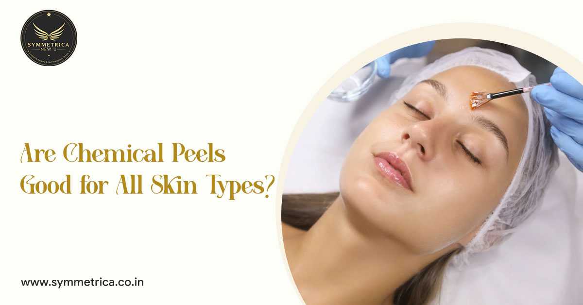 Are Chemical Peels Good for All Skin Types?