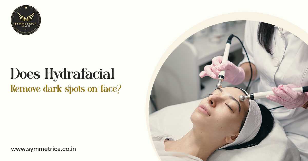 HydraFacial Treatment in Siliguri for improving dark spots, uneven skin tone, and glowing skin at Symmetrica