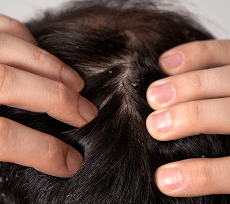 Chemically Treated Hair