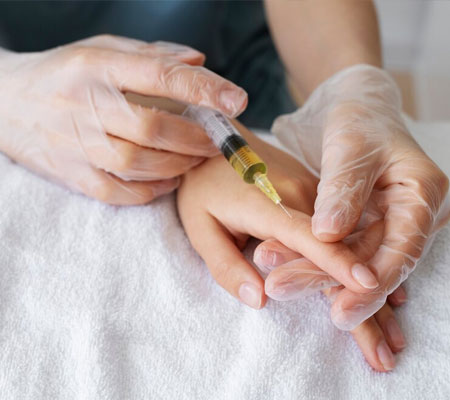 Dermal Filler for Hands