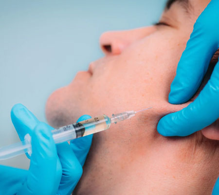 Dermal Filler for Jawline Definition