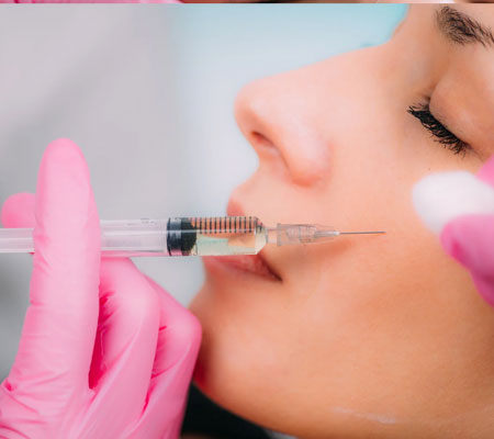 Dermal Filler for Cheeks